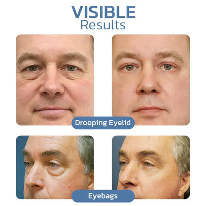 Odeiun™ Peptide PowerLift Eye Gel